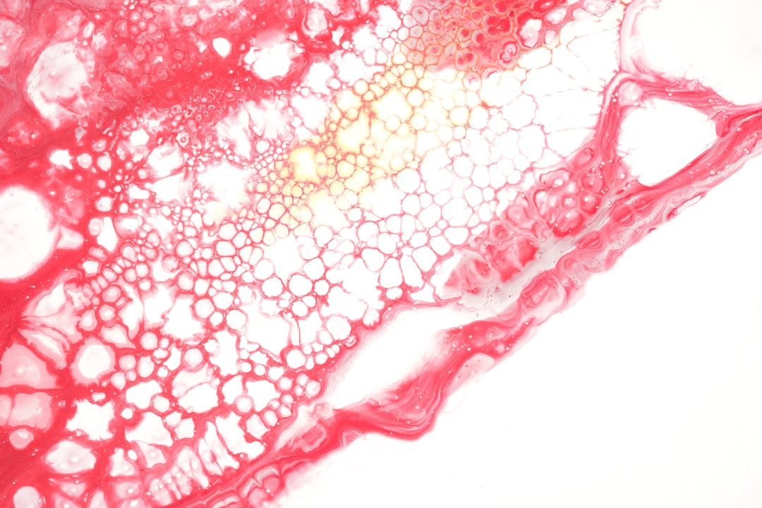 le syndrome de diogène : comprendre ce trouble complexe caractérisé par l'accumulation compulsive, le retrait social et le négligence de soi pour mieux aider les personnes affectées.