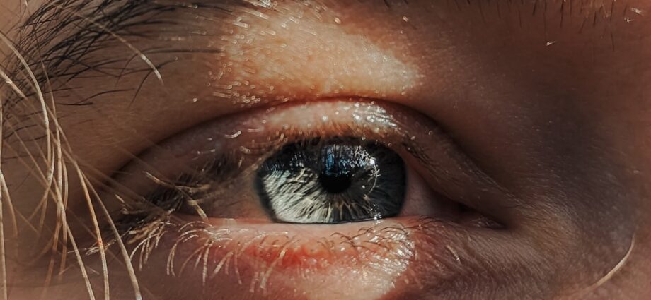 découvrez les symptômes courants des yeux secs, leurs causes possibles et les solutions pour soulager l'inconfort oculaire.