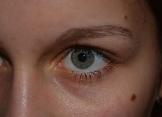 grain-de-beaute