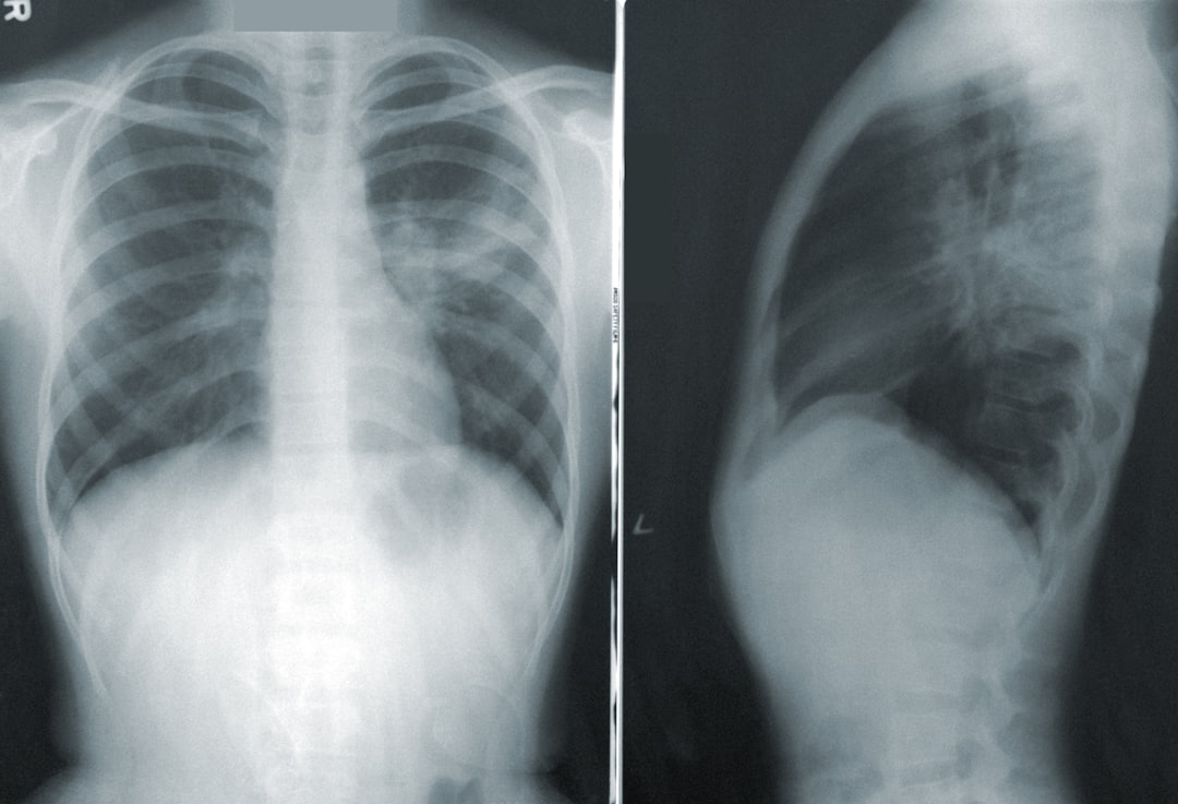 découvrez les symptômes de l'hyperthyroïdie, un trouble qui affecte la glande thyroïde et peut entraîner fatigue, perte de poids, palpitations et nervosité.