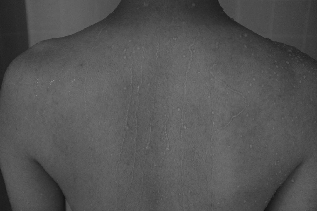 découvrez les symptômes de l'hyperthyroïdie, une affection où la glande thyroïde est hyperactive, provoquant fatigue, palpitations, perte de poids et nervosité.