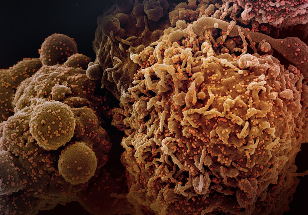 découvrez les symptômes du cancer du foie pour une détection précoce et un traitement efficace. informez-vous sur les signes à surveiller.