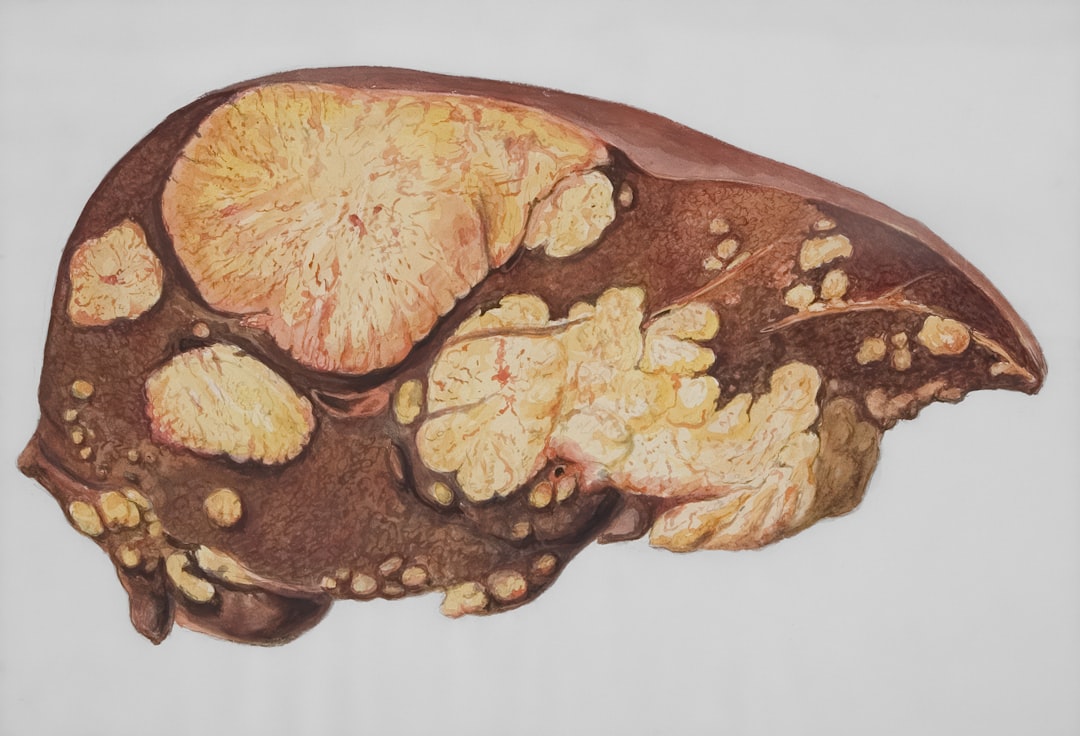 découvrez nos conseils et astuces pour préserver la santé de votre foie, prévenir les maladies hépatiques et adopter une alimentation favorable au bien-être hépatique.