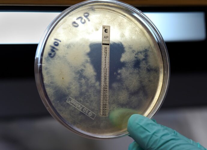 découvrez les symptômes de la méningite, une infection grave affectant les membranes du cerveau et de la moelle épinière. informez-vous sur les signes à surveiller pour agir rapidement.