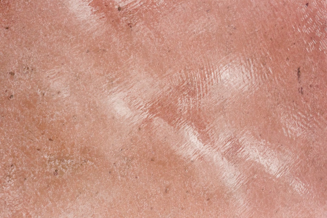 découvrez les symptômes du zona, une infection virale douloureuse, incluant éruptions cutanées, douleurs brûlantes et démangeaisons. apprenez à reconnaître les signes précoces pour mieux agir.