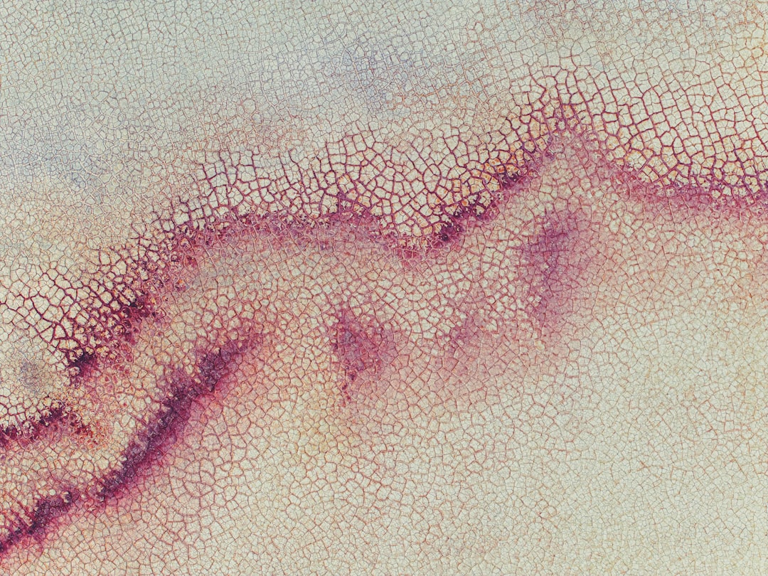 découvrez les symptômes du zona, une infection virale douloureuse, pour mieux identifier et traiter cette maladie rapidement.