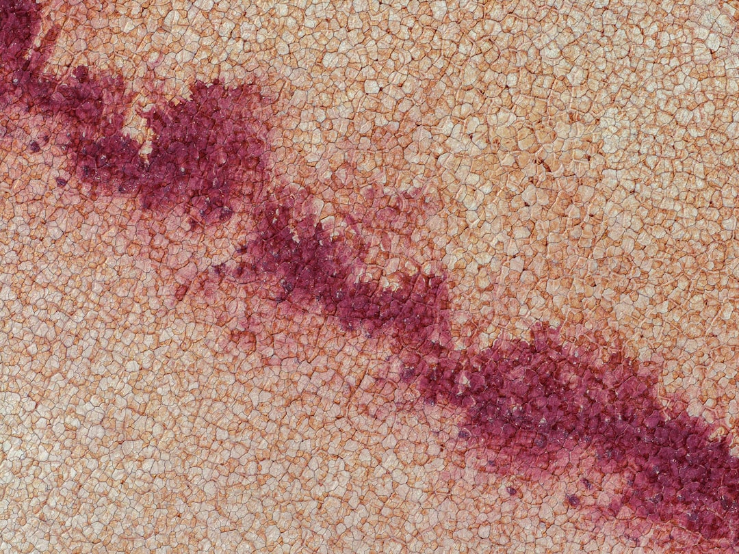 découvrez les symptômes du zona, une infection virale douloureuse caractérisée par une éruption cutanée, des douleurs et des démangeaisons. informez-vous pour mieux comprendre et reconnaître cette maladie.