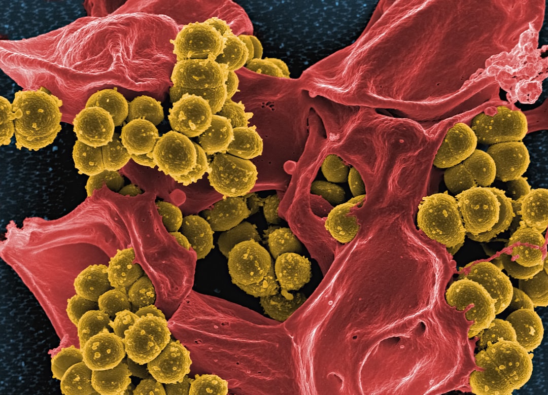 découvrez les symptômes d'une infection à staphylocoque, leurs signaux d'alerte, et comment reconnaître rapidement cette infection bactérienne courante.
