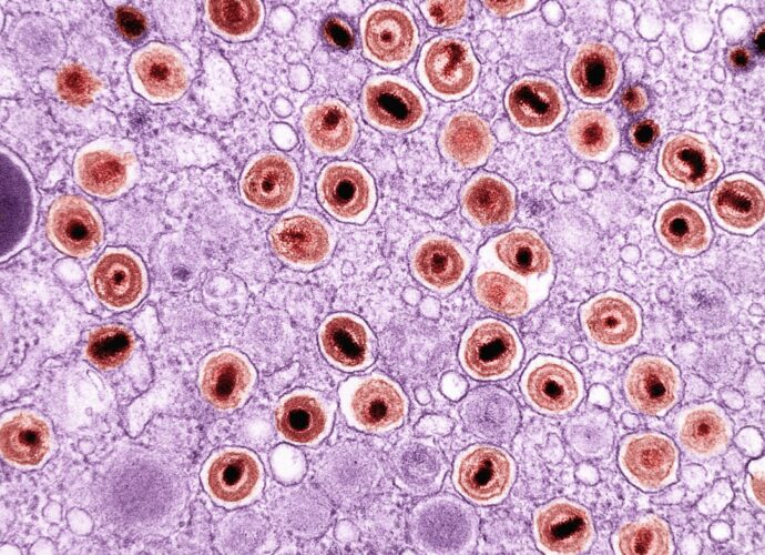 découvrez les symptômes courants des infections à staphylocoques, comment les reconnaître rapidement et les mesures à prendre pour une prise en charge efficace.