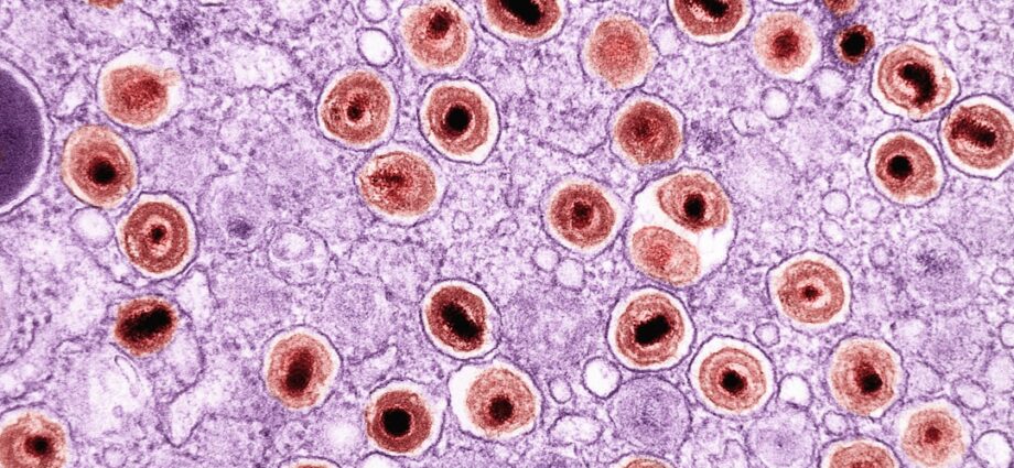 découvrez les symptômes courants des infections à staphylocoques, comment les reconnaître rapidement et les mesures à prendre pour une prise en charge efficace.