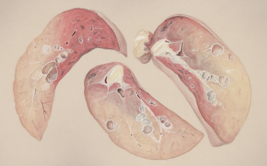 découvrez les symptômes courants des ulcères d'estomac pour mieux comprendre cette affection digestive et savoir quand consulter un médecin.