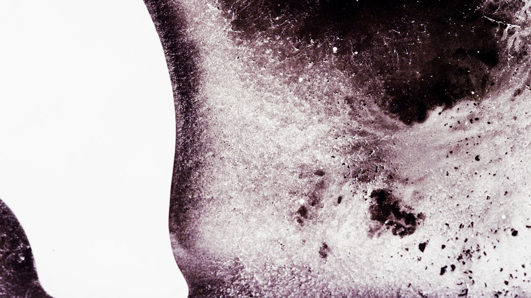 découvrez les symptômes courants de la thyroïde, leurs effets sur la santé, et quand consulter un spécialiste pour un diagnostic précis.
