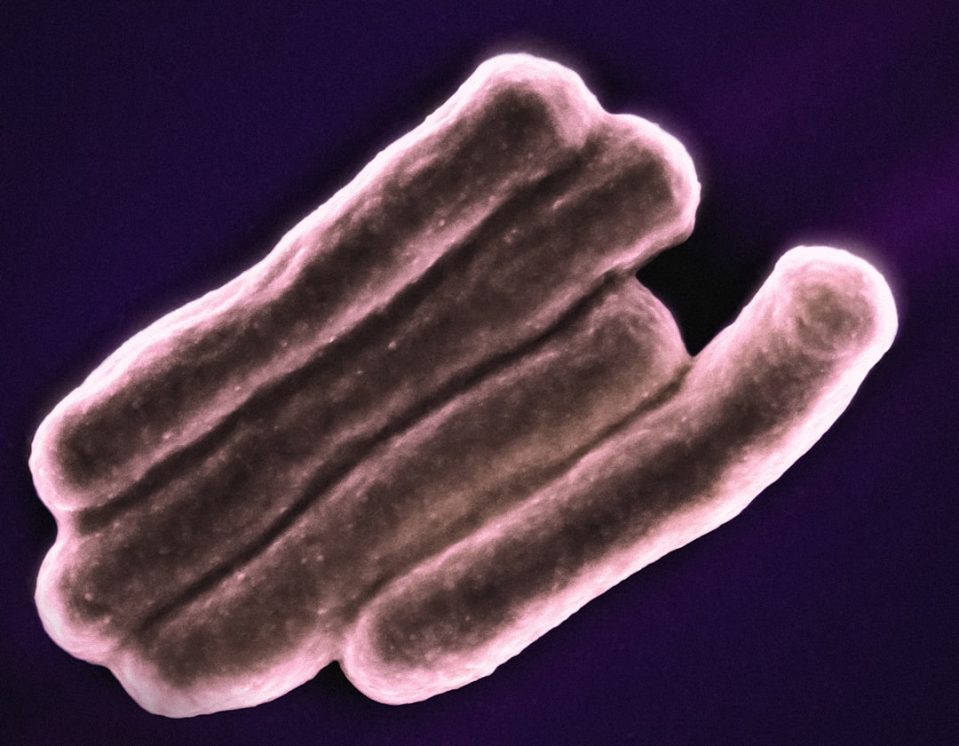 découvrez les principaux symptômes de la tuberculose, une maladie infectieuse qui affecte principalement les poumons. informez-vous sur les signes à surveiller pour un diagnostic précoce.