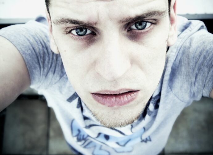 yeux et cernes