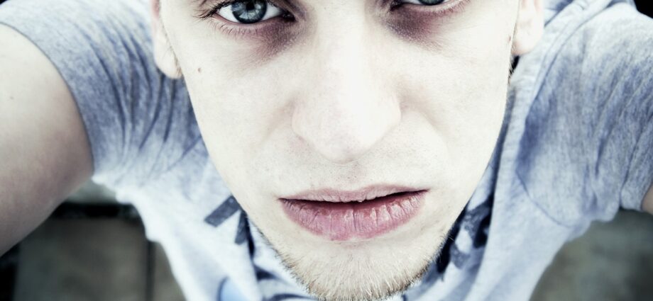 yeux et cernes
